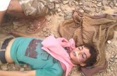 الطفل مازن الزريقي يبلغ من العمر 15 عاما  