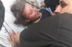 غزة تحت القصف (3).jpeg