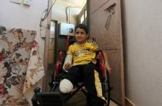 الطفل المصاب صالح حميد ‫(29011854)‬ ‫‬.jpg