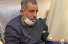 نجاة مواطن من اعتداء المستوطنين عليه في رهط.JPG