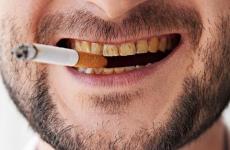اضرار التدخين على الاسنان.jpg