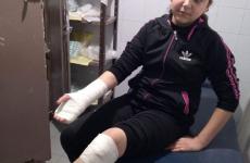 اصابة طفلة.jpg