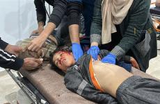 إصابات تصل إلى مستشفى العودة بالنصيرات بعد قصف إٍسرائيلي 2.jpg