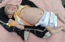 الرضيعة جنان السكافي.jpg