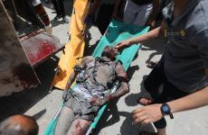 شهداء وإصابات في غزة 1.jfif