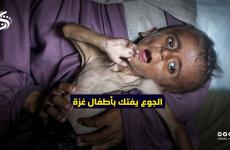 الجوع سوء تغذية التجويع أطفال غزة