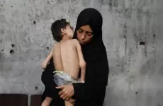 ازمة الجوع في غزة.webp