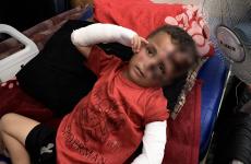 طفل من غزة مصاب جراء قصف اسرائيلي ناجي وحيد