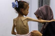 المجاعة في قطاع غزة.jpg