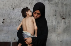 المجاعة - غزة