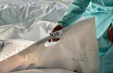 جثامين الشهداء