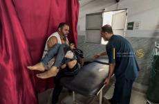 إصابات في قصف إسرائيلي في غزة 1.jpg