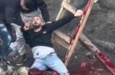 الشاب المصاب برصاص الاحتلال في الرام.png