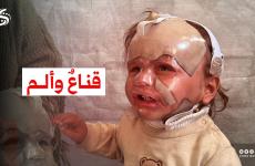 الطفل حجيلة