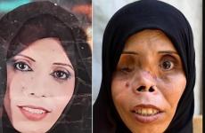 مأساة المواطنة نجوى أبو عطيوي .jpg