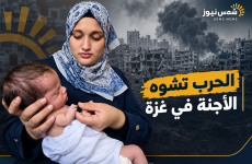 فايقة العريدي تلد طفلتها بدون يدين