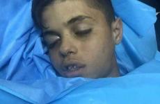 الطفل الشهيد محيي الطباخي