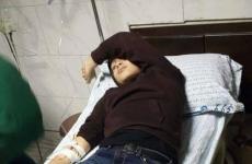 إحدي الاصابات