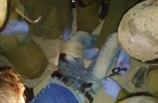 صورة الشاب المصاب في حزما