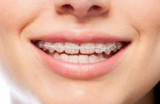 فراغ بين الأسنان.jpg