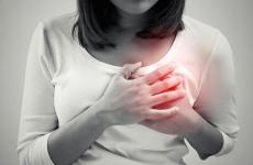 سكتة قلبية   نساء