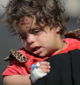 الطفلة جنة متلازمة داون وشقيقها عبدالله عبد الهادي هما الناجين الوحيدين من مجزرة استهدفت عائلتهم في مخيم البريج وسط قطاع غزة