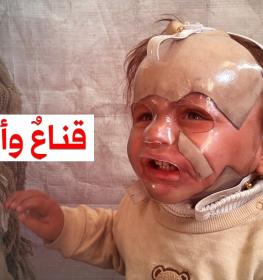 الطفل حجيلة