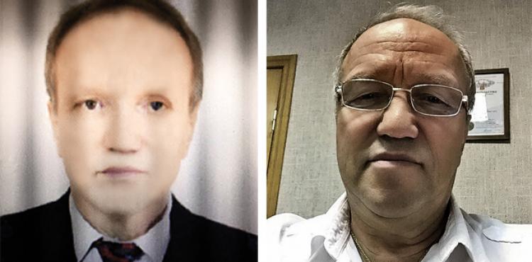 سيمين جيندلر قبل وبعد العملية