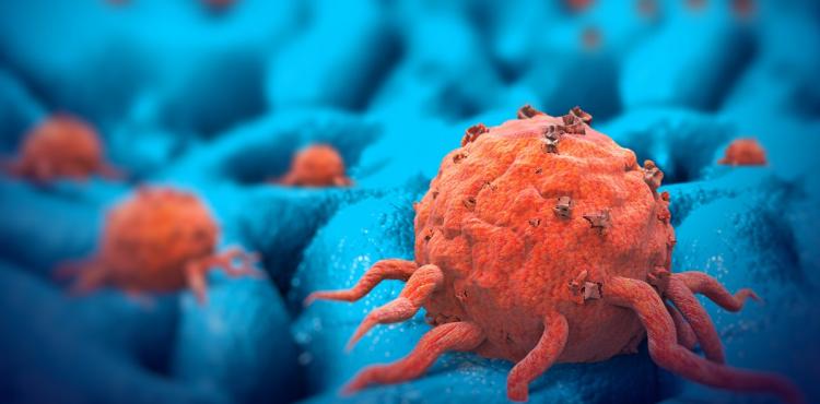 سرطان.jpg