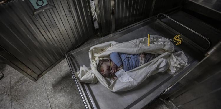 العدوان على غزة (31).jpeg