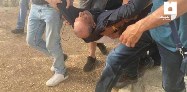 إصبات خلال مواجهات مع الاحتلال بالأقصى (1).jpg