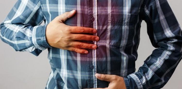 حموضة معدة.jpg