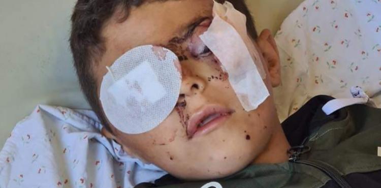 الطفل محمد شعبان.jpg