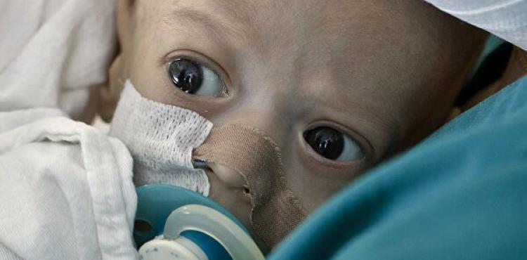 وفاة طفل - صورة من جوجل.jpg