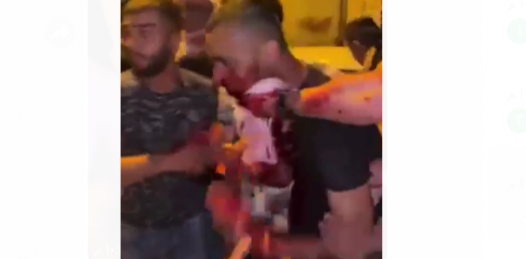 إصابة شاب برصاص الاحتلال في الرقبة.PNG