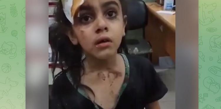طفلة ناجية.JPG
