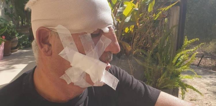 مستوطنون يعتدون على المواطنين في نابلس  3.jpg