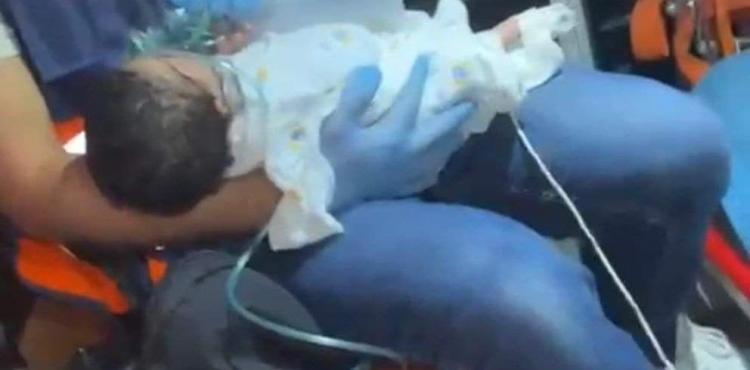 إصابة رضيعة بالاختناق.jpg