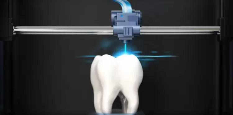 الأسنان - سن - طب الفم والأسنان.webp