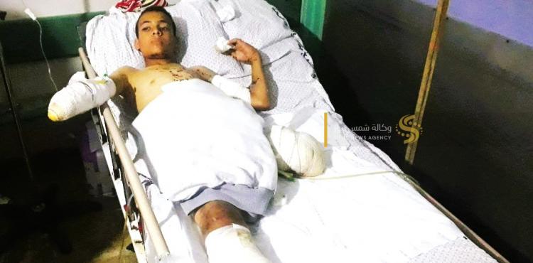 الطفل يزن الحرازين