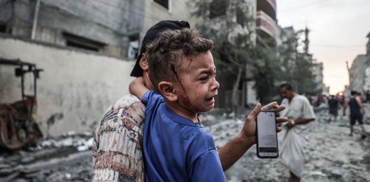 أطفال مصابة في غزة.jpg