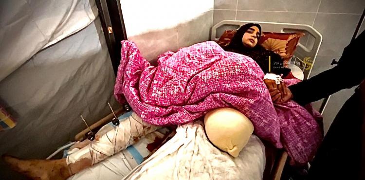 فريال الشوربجي المصابة.jpg