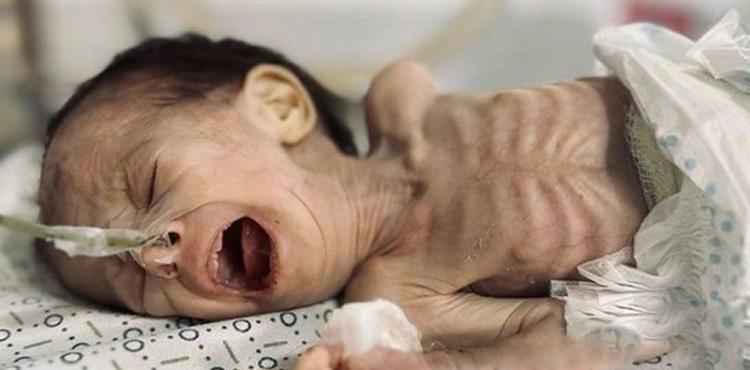 طفلة حديثة الولادة في غزة.jpg