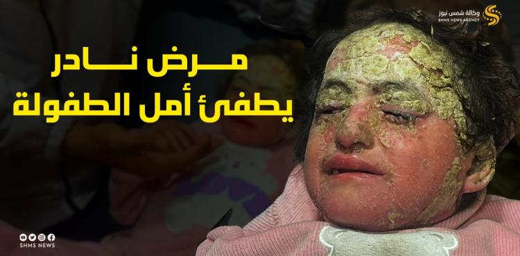 الطفلة مريم أبو هلال.jpg