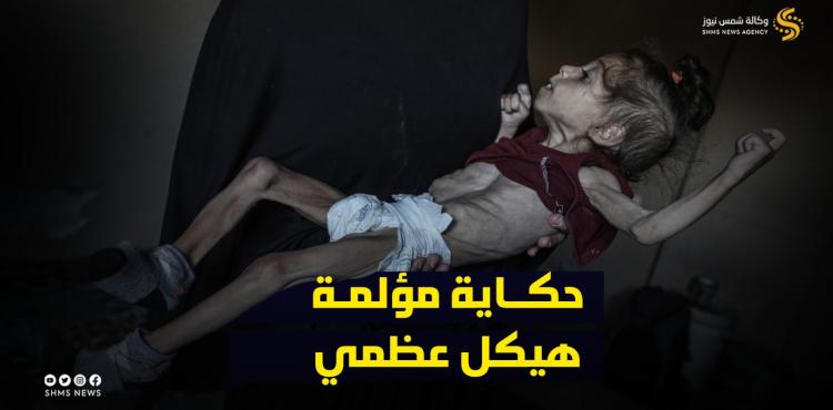 الطفلة مسك المدهون.jpg