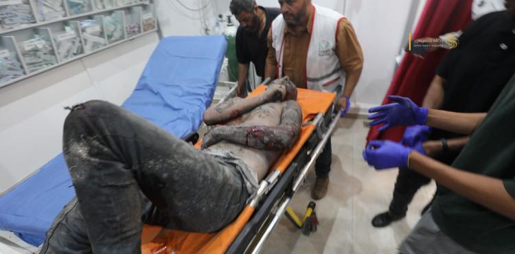 شهداء وإصابات في غزة