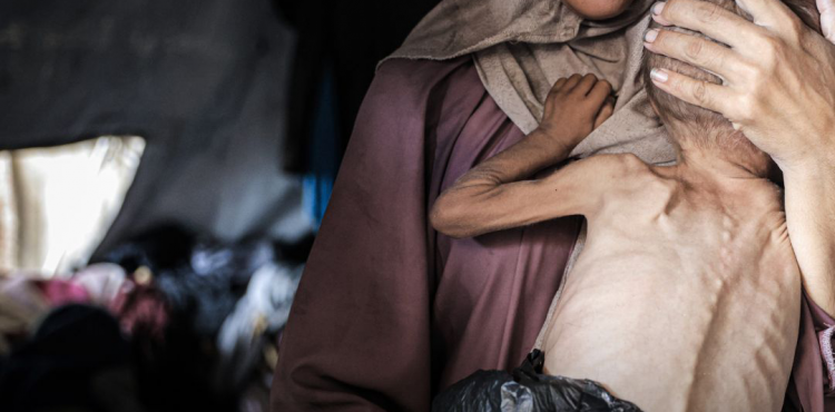 المجاعة في غزة