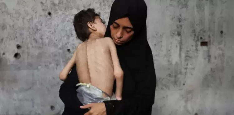 ازمة الجوع في غزة.webp