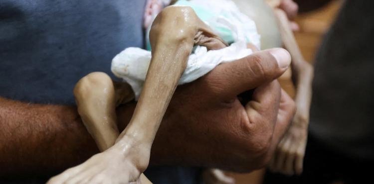 المجاعة غزة