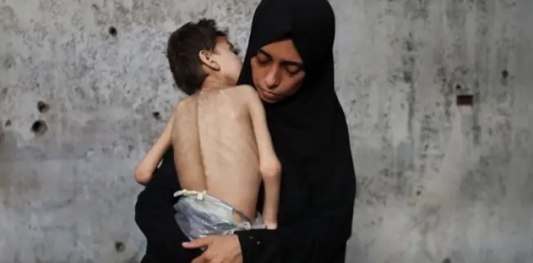 المجاعة - غزة